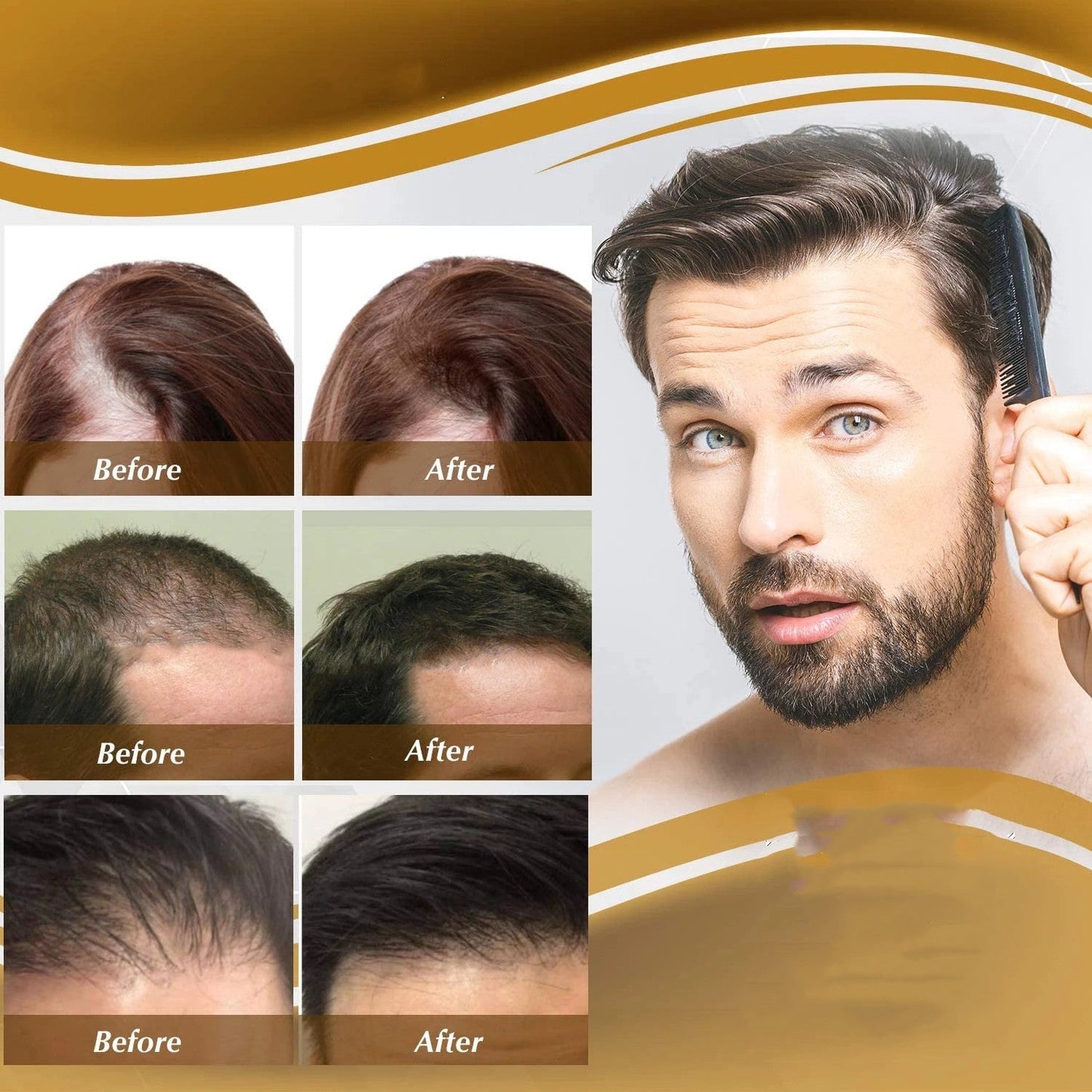 Anti Hair Loss Nourishing & Hair Growth Liquid
