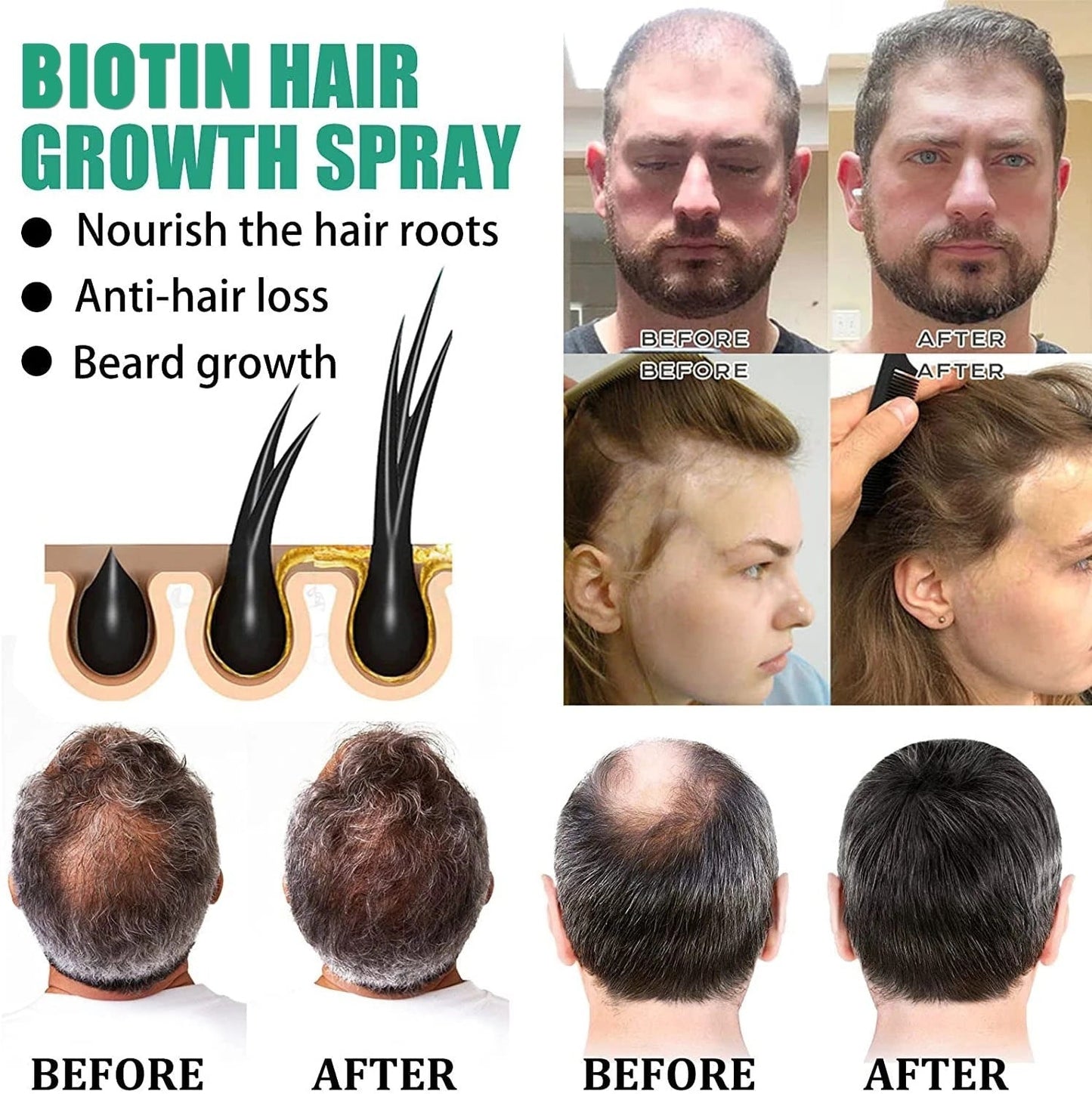 Anti Hair Loss Nourishing & Hair Growth Liquid
